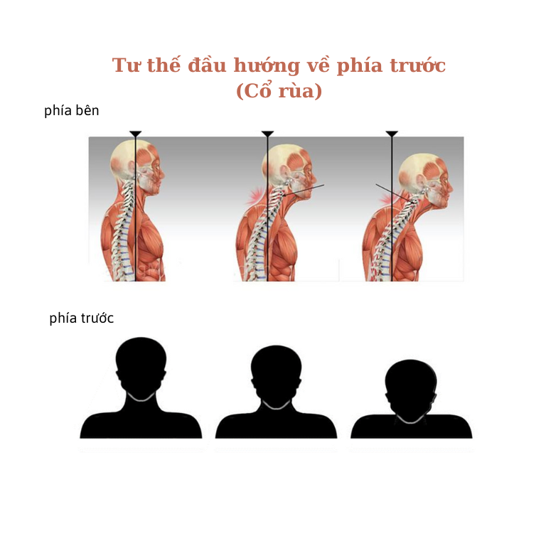 TƯ THẾ ĐẦU HƯỚNG VỀ PHÍA TRƯỚC