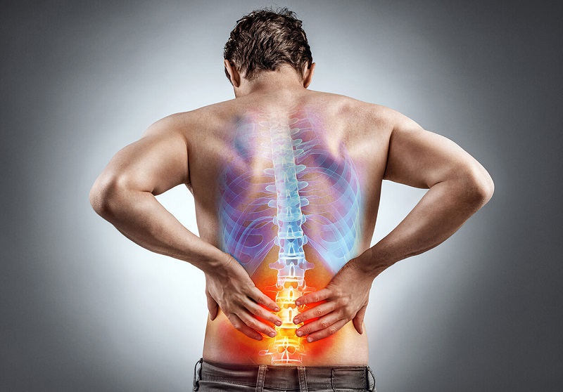 CẢI THIỆN TƯ THẾ GIẢM ĐAU LƯNG